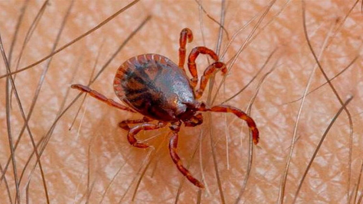 La rara enfermedad del virus Powassan que está en aumento en EEUU y se transmite por garrapatas