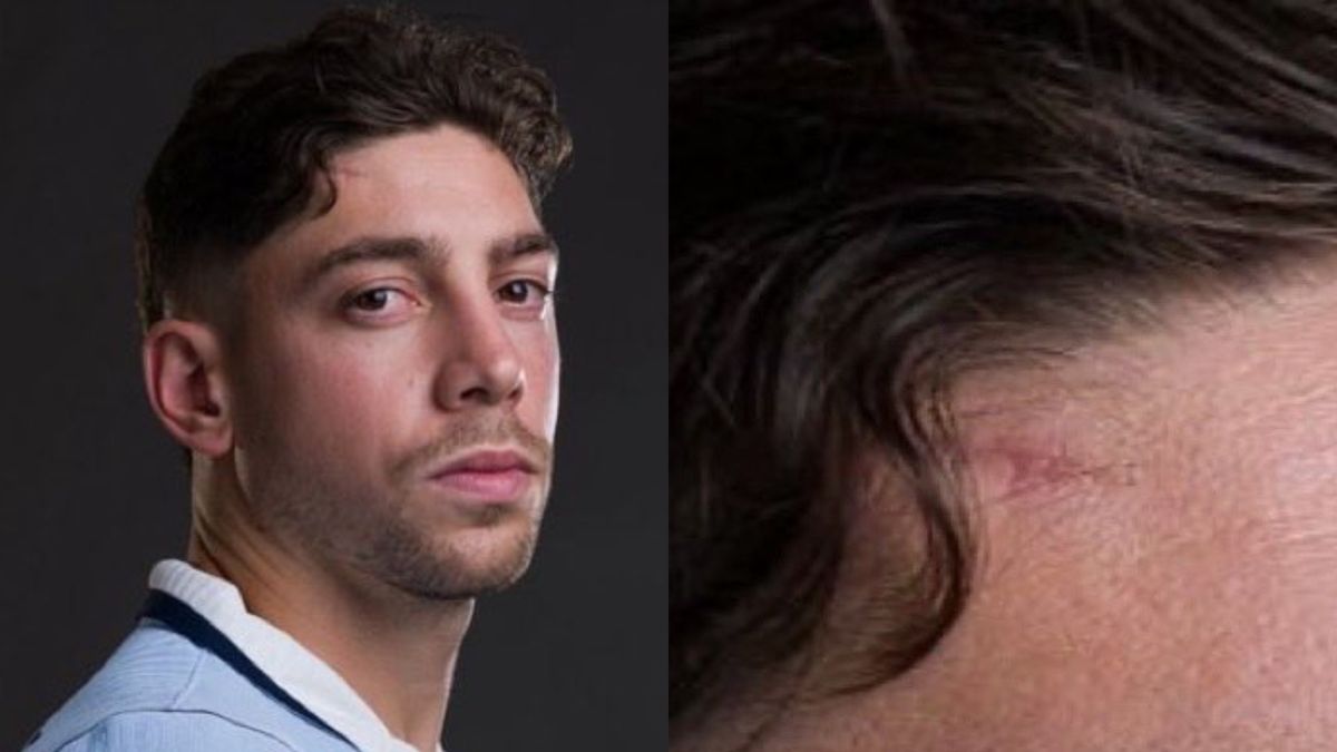 La foto oficial de Federico Valverde de Uruguay y el detalle en su frente que acaparó las miradas: qué pasó